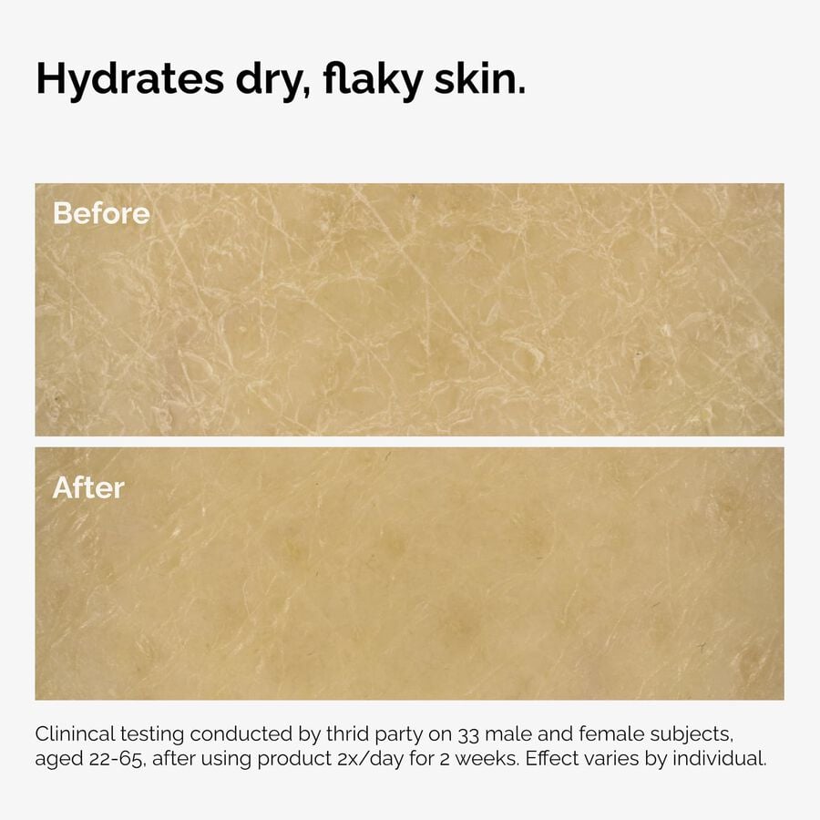 the-body-care-collection-q5 ord-natural-moisturizing-factors-inulin-body-before-after-graphic-02.jpg