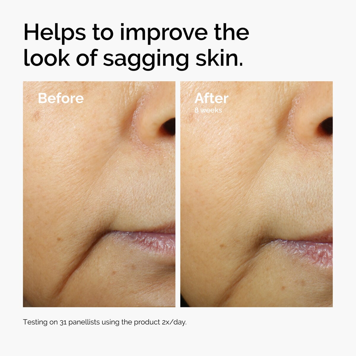 caffeine-3-escin-1-face-serum-x2 ord-caffeine-3pct-escin-1pct-face-serum-before-after-sagging.jpg