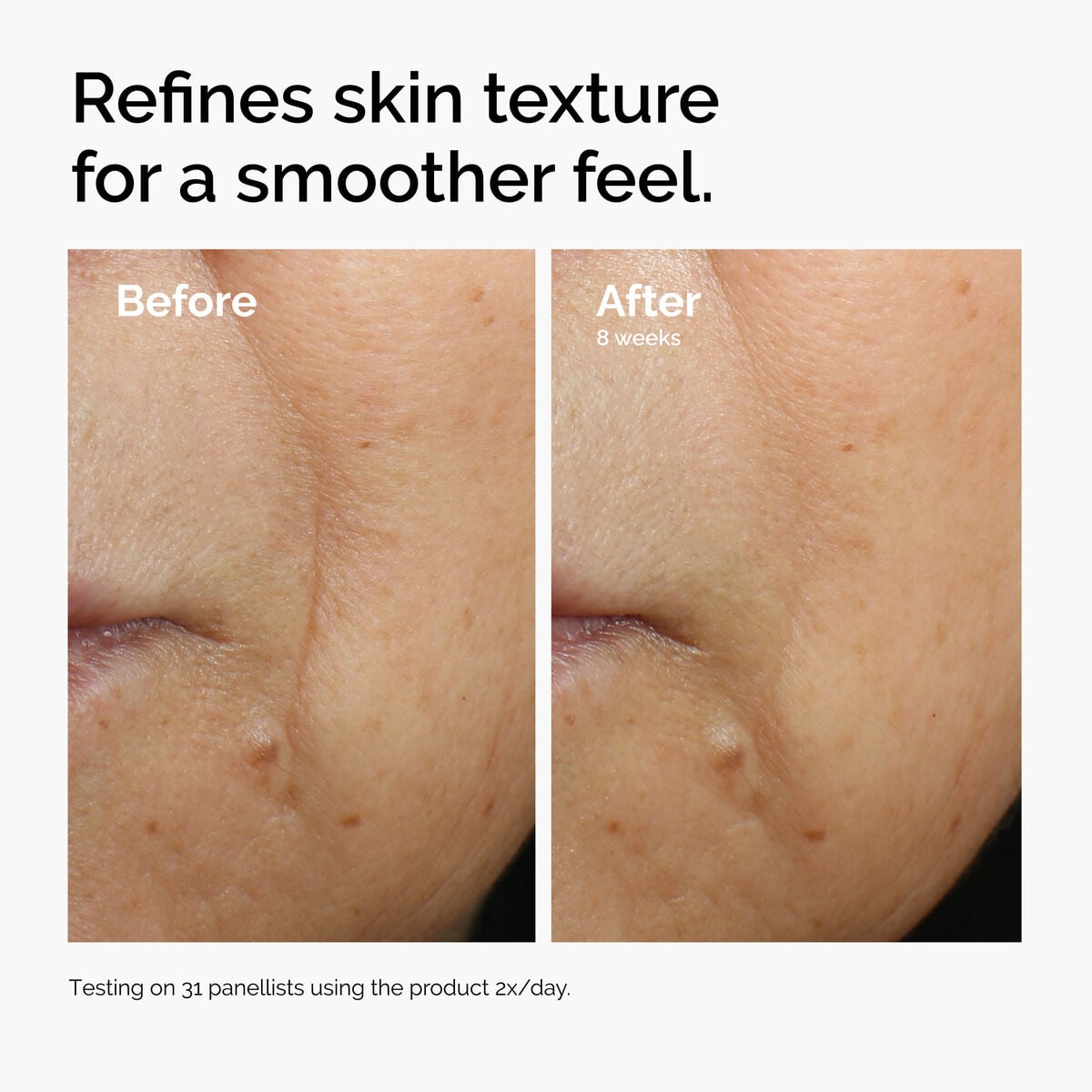 caffeine-3-escin-1-face-serum-x2 ord-caffeine-3pct-escin-1pct-face-serum-before-after-texture.jpg