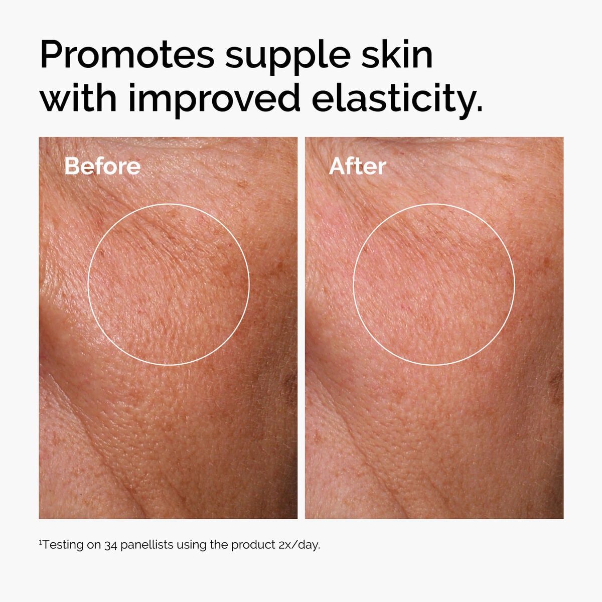 hyaluronic-acid-2-b5-with-ceramides-b2 ord-hyaluronic-acid-2pct-b5-hydrating-serum-before-after-elasticity.jpg