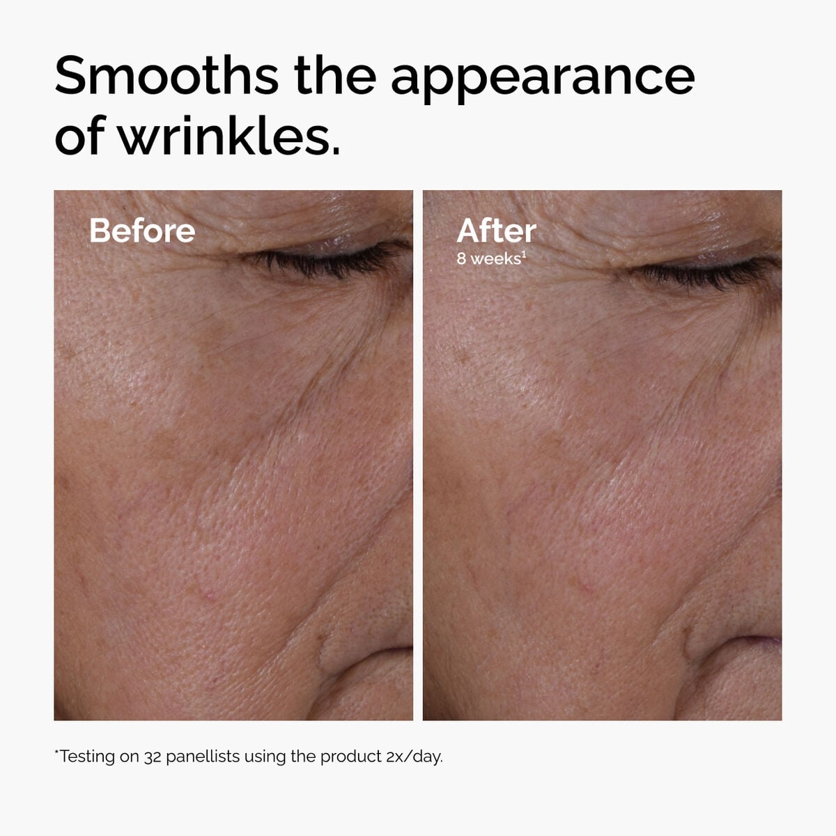 multi-peptide-ha-serum-p2 ord-multi-peptide-ha-serum-wrinkles-before-after.jpg