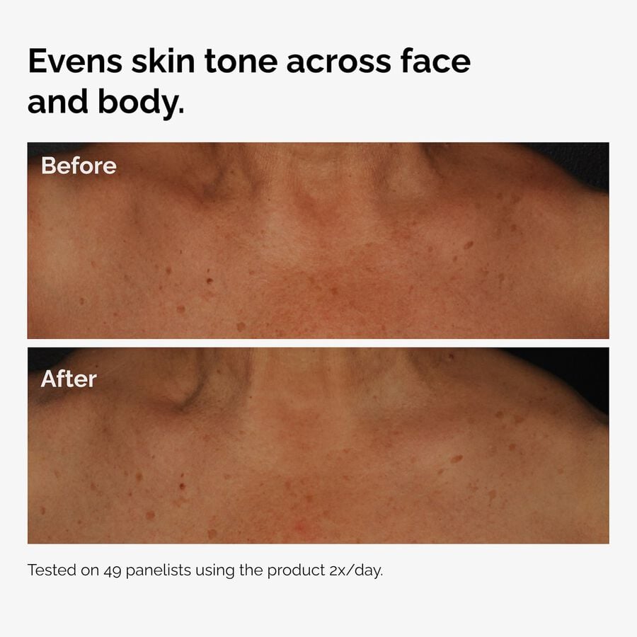 the-body-care-collection-q5 ord-niacinamide-face-body-serum-before-after-even-tone-graphic.jpg
