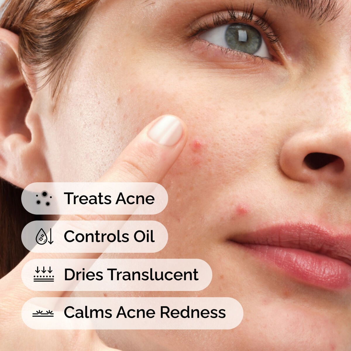 sulfur-10-powder-to-cream-concentrate-t4 ord-sulfur-10pct-powder-to-cream-concentrate-model-application-with-benefits-acne.jpg
